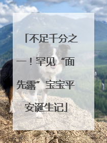 不足千分之一！罕见“面先露”宝宝平安诞生记
